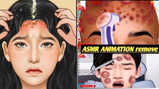 ASMR ANIMATION REMOVEface clear skin doctor [upl. by Esinart]