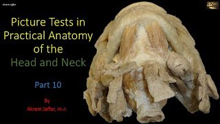 Picture tests in head and neck anatomy 10 [upl. by Yrellam]