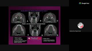 Tomografía Cone Beam para ortodoncia [upl. by Theadora754]