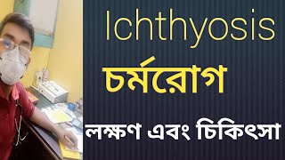 Ichthyosis চর্মরোগ কি [upl. by Ecaj]