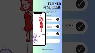 quotEmpowering Life Turner Syndrome Insights in 21 Secondsquot [upl. by Cote312]