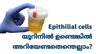 Epithelial Cells in Urine Malayalam [upl. by Jabez]