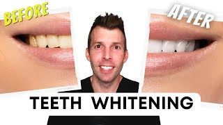 The best way to whiten teeth what really works [upl. by Cence]