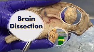 Brain Dissection [upl. by Buonomo]