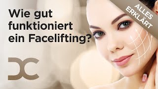 Facelifting amp Halsstraffung Sind natürliche Ergebnisse möglich  Dorow Clinic [upl. by Lluj965]