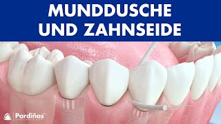 Munddusche und Zahnseide ImplantatPflege © [upl. by Ahsilyt660]