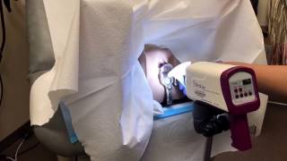 Colposcopy training video [upl. by Mcquillin699]