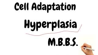 Cell Adaptation Part 2 Hyperplasia  Pathology Notes  Pathology MBBS Notes [upl. by Novelia795]