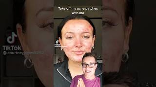 😨THE TRUTH ABOUT PIMPLE PATCHES What TikTok Doesnt Tell You shorts [upl. by Jacintha700]