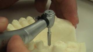 Dental implant surgery training video [upl. by Alurd]