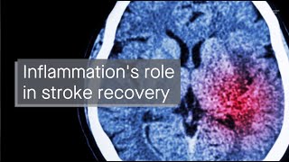 How inflammation affects stroke recovery [upl. by Llenral]