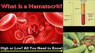 Hematocrit – Normal Range Low and High Levels Causes [upl. by Eelirrem892]