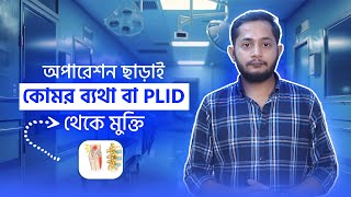 অপারেশন ছাড়াই কোমর ব্যথা বা PLID থেকে মুক্তি। কোমরব্যথা পিএলআইডি [upl. by Pilihp]