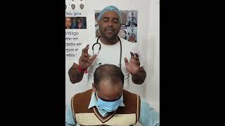 BEFORE AND AFTER Hair regrowth hair treatment videochange your lookcustomer Revewmohanpurup [upl. by Gilbertson421]