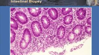 T Cell Effector Function Part 2  Th17 and T Regulatory Cells in Health and Disease [upl. by Ahseekan]