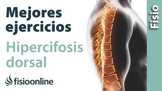 Los mejores ejercicios para corregir la hipercifosis dorsal o chepa [upl. by Sergo432]