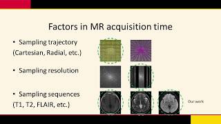 MIDL 2020 O018 Peng et al Oral presentation [upl. by Imarej2]