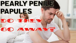 Does Pearly Penile Papules Go Away [upl. by Assiroc871]