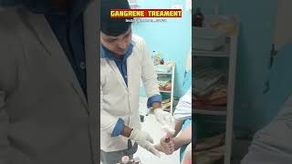 Gangrene Treatment in Hospital shorts shortsvideo hospital medical treatment nursing short [upl. by Yanarp]