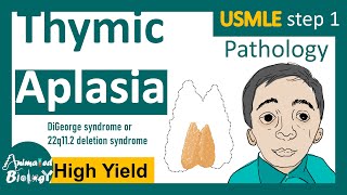 Thymic Aplasia  DiGeorge syndrome  22q112 deletion syndrome  USMLE step 1 [upl. by Sibie]