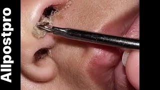 Cleaning baby nose 😍 Super satisfying [upl. by Sabsay]