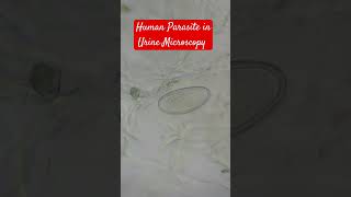 Human Parasite in Urine Microscopy  Egg of Enterobius vermicularis  Pinworm [upl. by Minna]