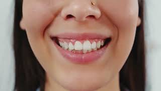 Top 3 Best Toothpaste For Teeth Whitening On Amazon Reviews [upl. by Eyla]