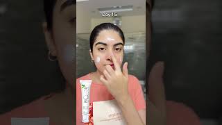 Bio2you 15 Day’s of Clear Skin Challenge❤️Shop wwwbiotwoyoucom bio2you skincareroutine skin [upl. by Naret111]