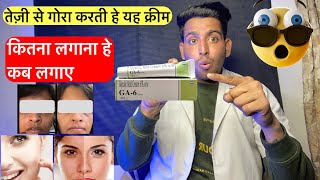 तेजी से गोरा करने वाली क्रीम  Ga 6 cream review  Glycolic acid cream 6 ww  Ga 6 cream how to use [upl. by Disharoon]