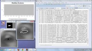 Low Cost Pupillometer [upl. by Juan]