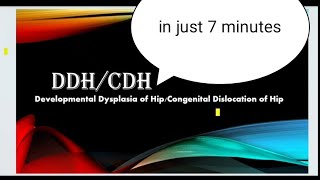 Congenital Dislocation of HipDevelopmental Dysplasia of Hip [upl. by Kashden574]