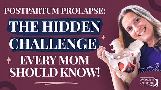 Understanding Prolapse Pelvic Floor Risks and Postpartum Challenges [upl. by Imotih]