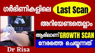 Last Scan In Pregnancy Malayalam  Growth Scan  Third Trimester Pregnancy Scan [upl. by Htrowslle651]