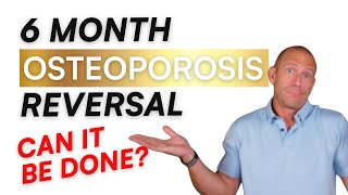 How to Reverse Osteoporosis in 6 Months [upl. by Jewell774]