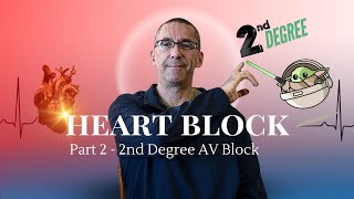 Heart Block Part 2  2nd Degree AV Block  Dr David Barold I ECG Simplified [upl. by Sutit]