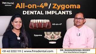 All on 4 Dental Implants  No Bone Zygoma Implants For No Bone l FMS Dental  DrRamakrishna Reddy [upl. by Iah391]