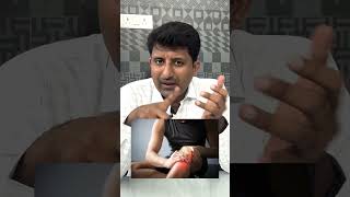 How to treat swelling after injury  Dr Jeya Venkatesh [upl. by Aneleiram]