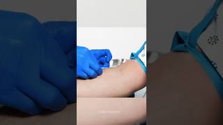 Vein Finder Device shorts facts sciencefacts [upl. by Palmira]