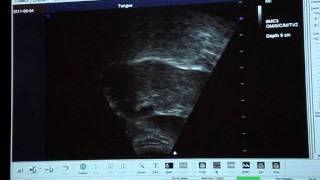 Ultrasound of the Clarinetists Tongue  14 [upl. by Broderick]