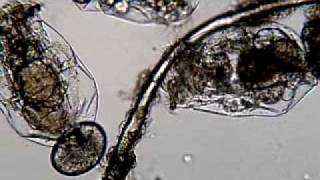 Rotifers under microscope [upl. by Anitsua]