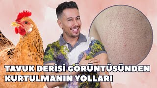 Tavuk Derisi Görüntüsünden Kurtulmanın Yolları 🐔 Keratosis Pilaris [upl. by Aitas]