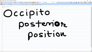 Occipito Posterior Position  types and Management [upl. by Werner]