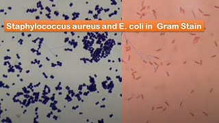 Staphylococcus aureus and E coli in Gram stain GPC in singles pairs Chains and clusters GNB [upl. by Ahsinehs]