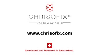 CHRISOFIX®  Introduction video [upl. by Ydospahr]