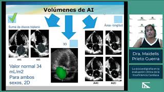 Ecocardiograma en la Insuficiencia Cardiaca [upl. by Ayram]