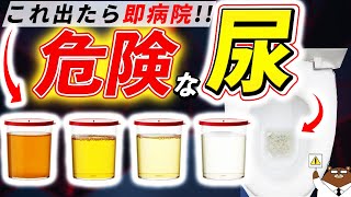 色・臭い・泡立ち・回数絶対に見逃してはいけない「おしっこ」からのSOS。知らないと後悔する超意外なサインとは？医師が徹底解説！ [upl. by Aislehc483]