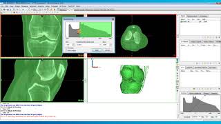 How to Perform Thresholding in Mimics  Mimics Innovation Suite  Materialise Medical [upl. by Najar]