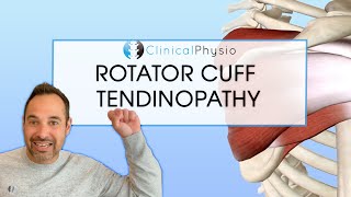 Rotator Cuff Tendinopathy  Expert Explains Mechanism Of Injury and Rehab Plan [upl. by Mellisent224]