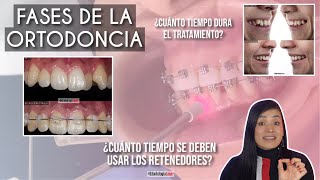 Fases de un tratamiento de Ortodoncia 🦷 ¿Cuánto puede durar un tratamiento 🤔  Odontología Láser [upl. by Knowling]