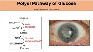 Polyol Pathway of Glucose amp Its Role in Diabetes  Sorbitol Pathway [upl. by Aillicec]